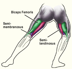 Hamstring Tendonitis