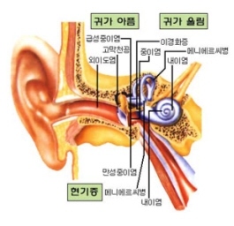 이어캔들 효능과 특징